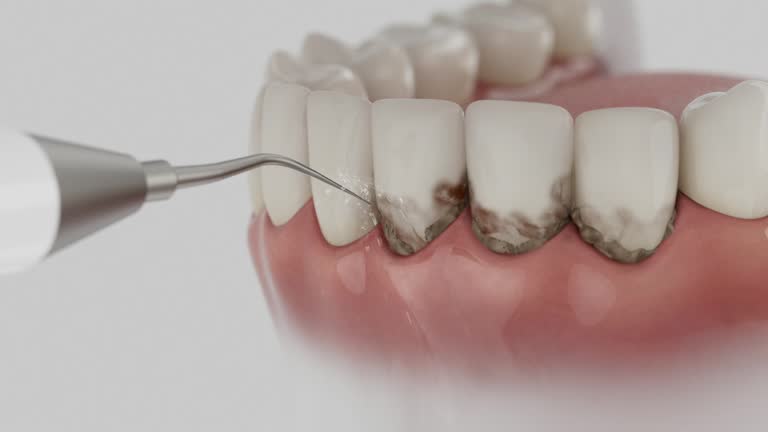 Trusted Emergency Dentist service in Fayette, MO - Dentist Open Now